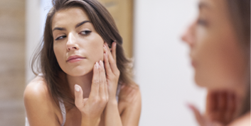 Acne scars